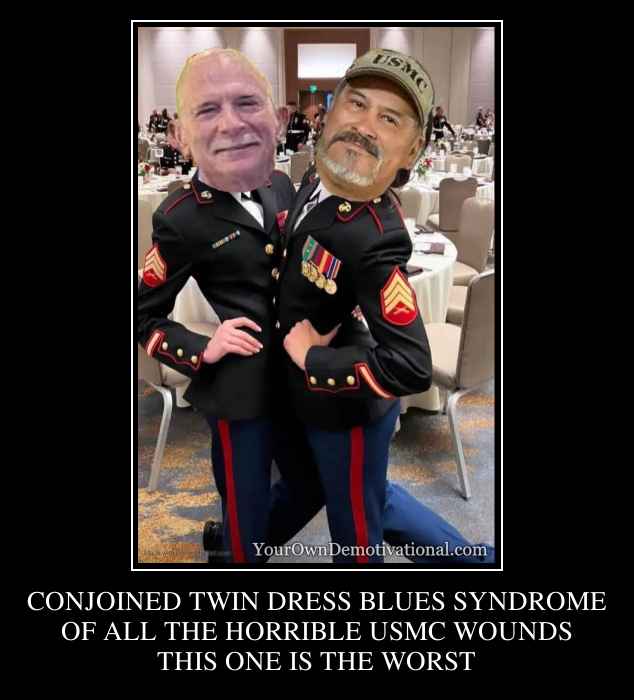CONJOINED TWIN DRESS BLUES SYNDROME